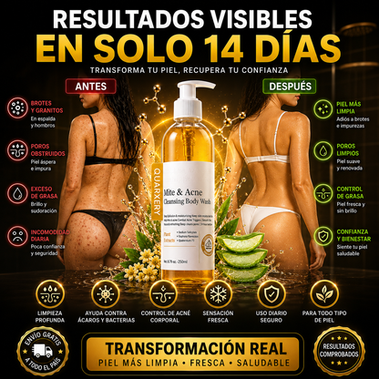 MiteClear™️ – Elimina Ácaros, Reduce el Acné y Recupera una Piel Limpia y Uniforme ✅